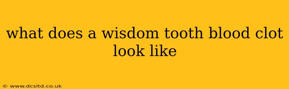 what does a wisdom tooth blood clot look like