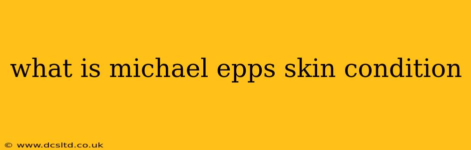 what is michael epps skin condition