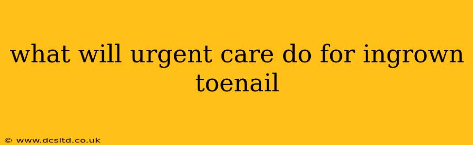 what will urgent care do for ingrown toenail