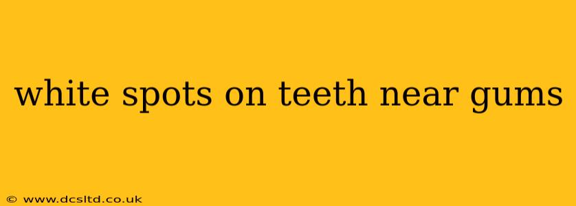 white spots on teeth near gums