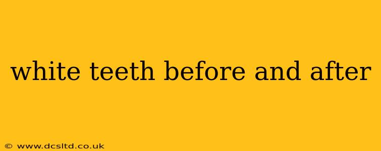 white teeth before and after