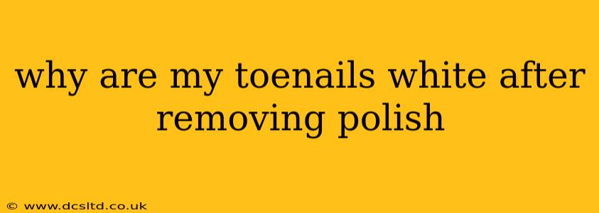 why are my toenails white after removing polish