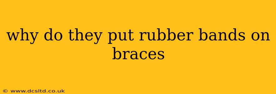 why do they put rubber bands on braces