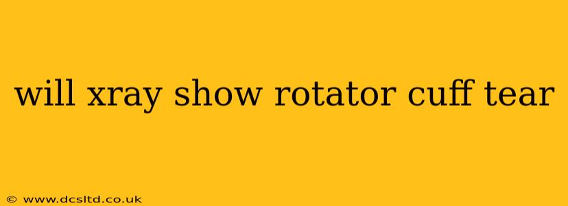 will xray show rotator cuff tear