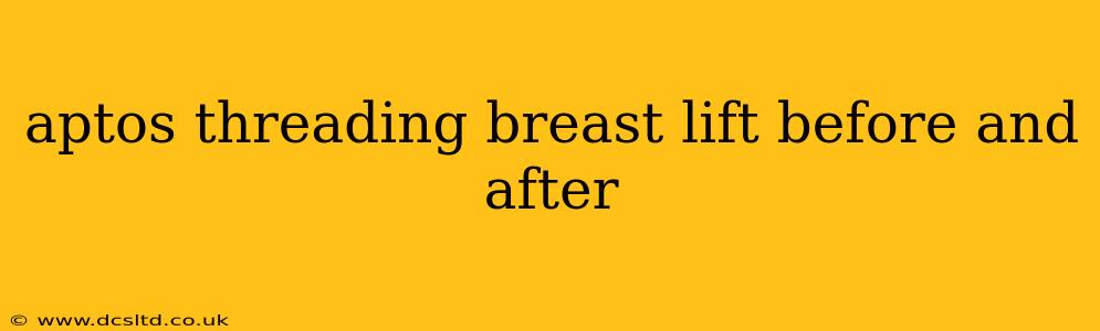 aptos threading breast lift before and after