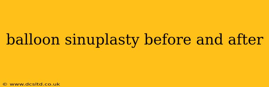 balloon sinuplasty before and after