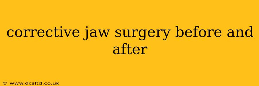 corrective jaw surgery before and after
