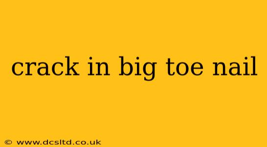 crack in big toe nail