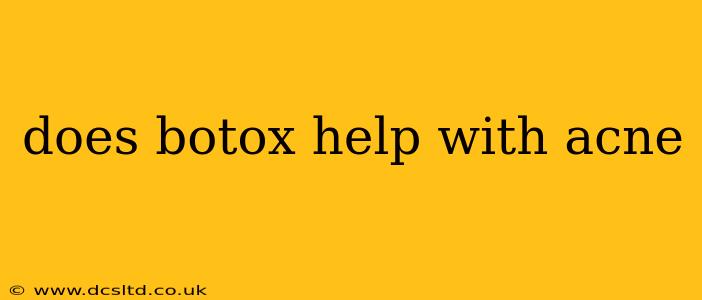 does botox help with acne