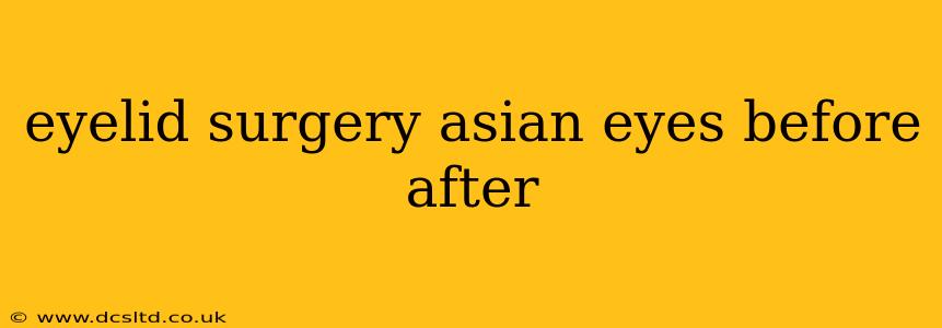 eyelid surgery asian eyes before after