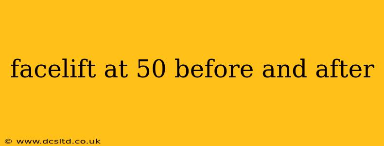facelift at 50 before and after