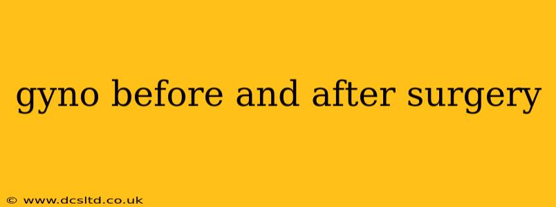 gyno before and after surgery