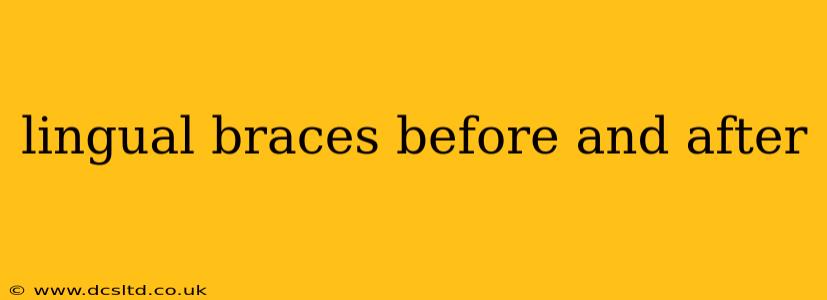 lingual braces before and after