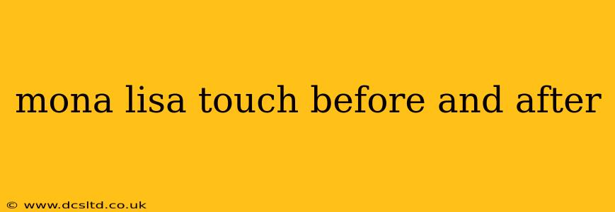 mona lisa touch before and after