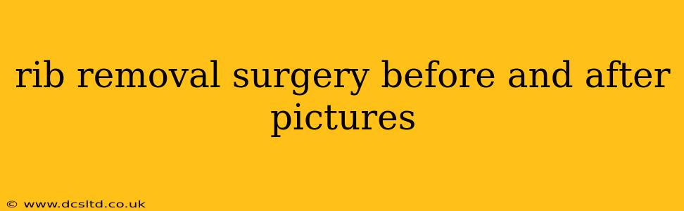 rib removal surgery before and after pictures
