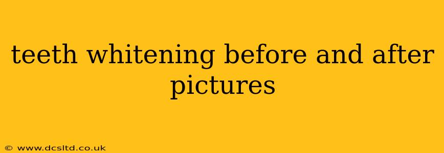 teeth whitening before and after pictures